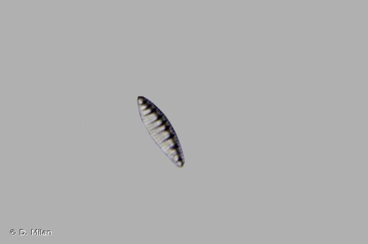 <i>Denticula kuetzingii</i> Grunow, 1862 © D. Milan